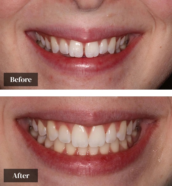 Boynton beach dentists