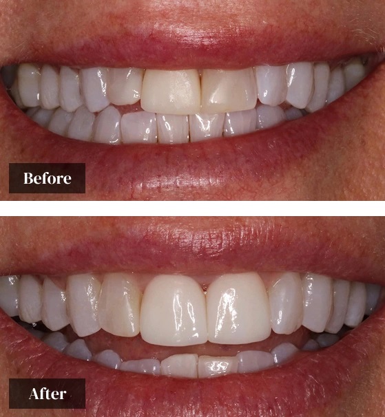 Dentist Boynton beach fl